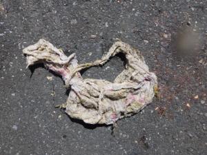 異物写真
