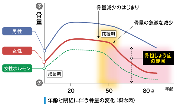 年齢に伴う女性ホルモンと骨量のグラフ