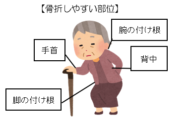 骨折しやすい部位(手首、腕の付け根、背中、足の付け根)